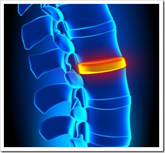 Herniated Disc and Back Pain Spokane WA