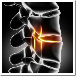 Slipped Disc Spokane WA